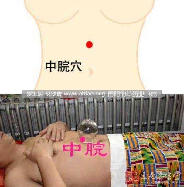 中脘穴位于腹部正中線，臍上4寸的位置上。每天艾灸10-15分鐘，能有效緩解胃部不適的癥狀，同時(shí)有助于祛濕。